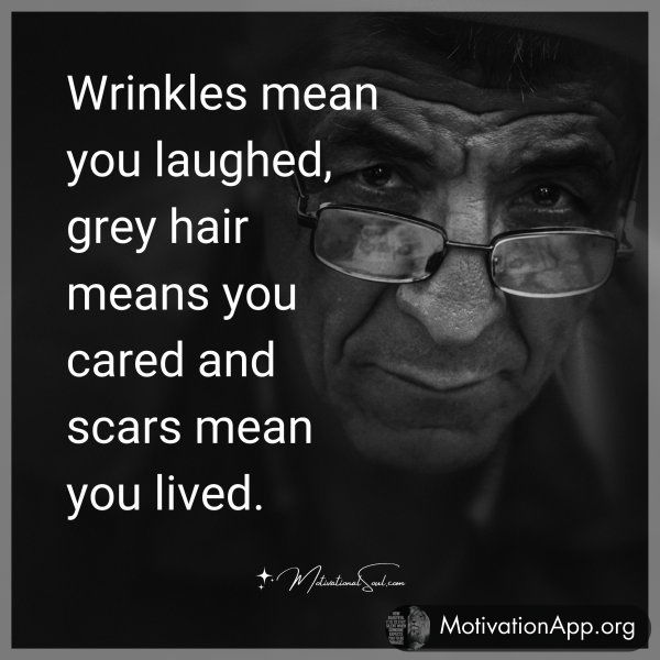 Wrinkles mean you laughed