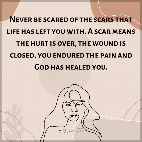 Quote: Never be scared of
the scars that life
has left you with