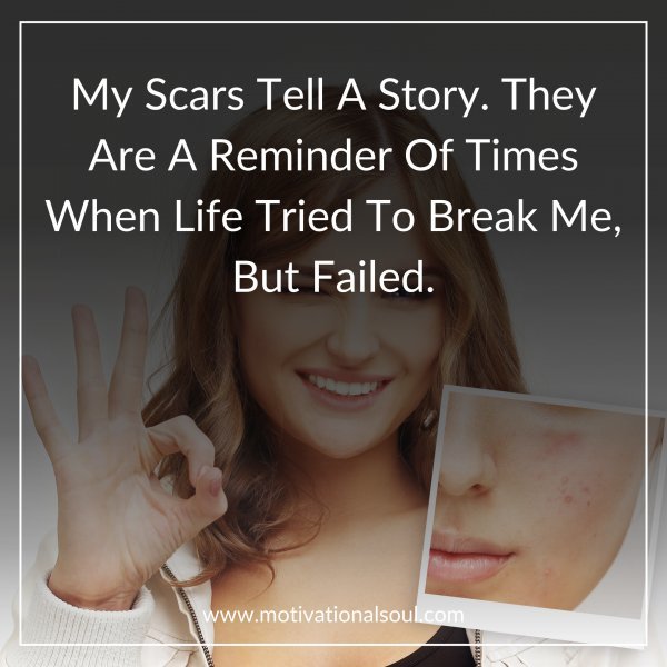 My Scars Tell