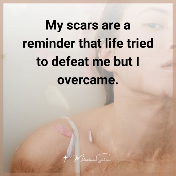 MY SCARS ARE A REMINDER