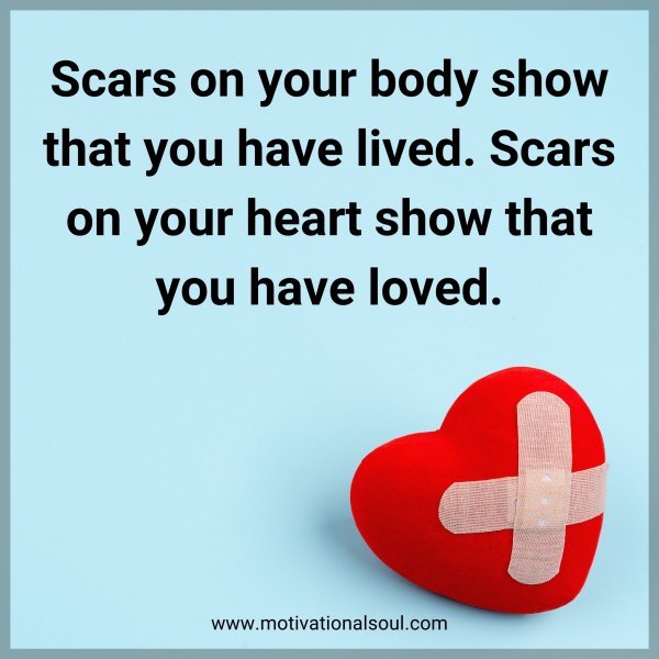 Scars on your body show that you have lived. Scars on your heart show that you have loved.